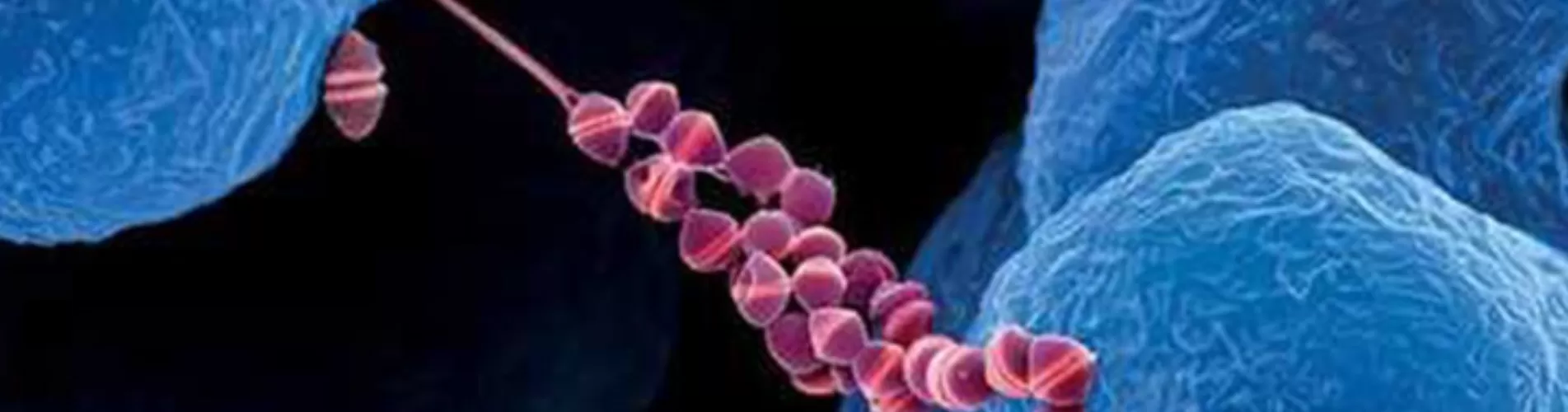 Warning: Streptococcus suis infections increasing in Hue – Multiple Severe Cases Reported